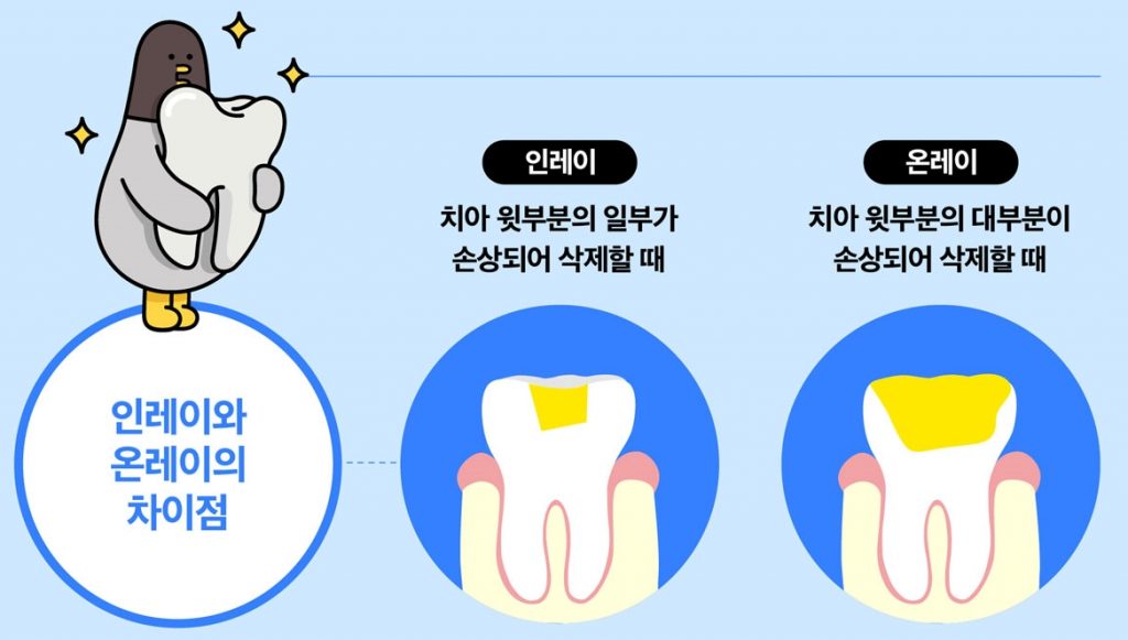 치과치료 치아보험