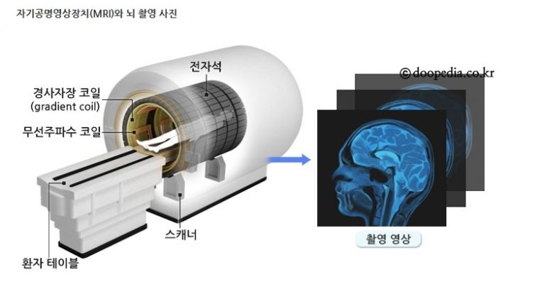 MRI검사